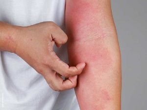 Klinik Asma Alergi Indrajana 3