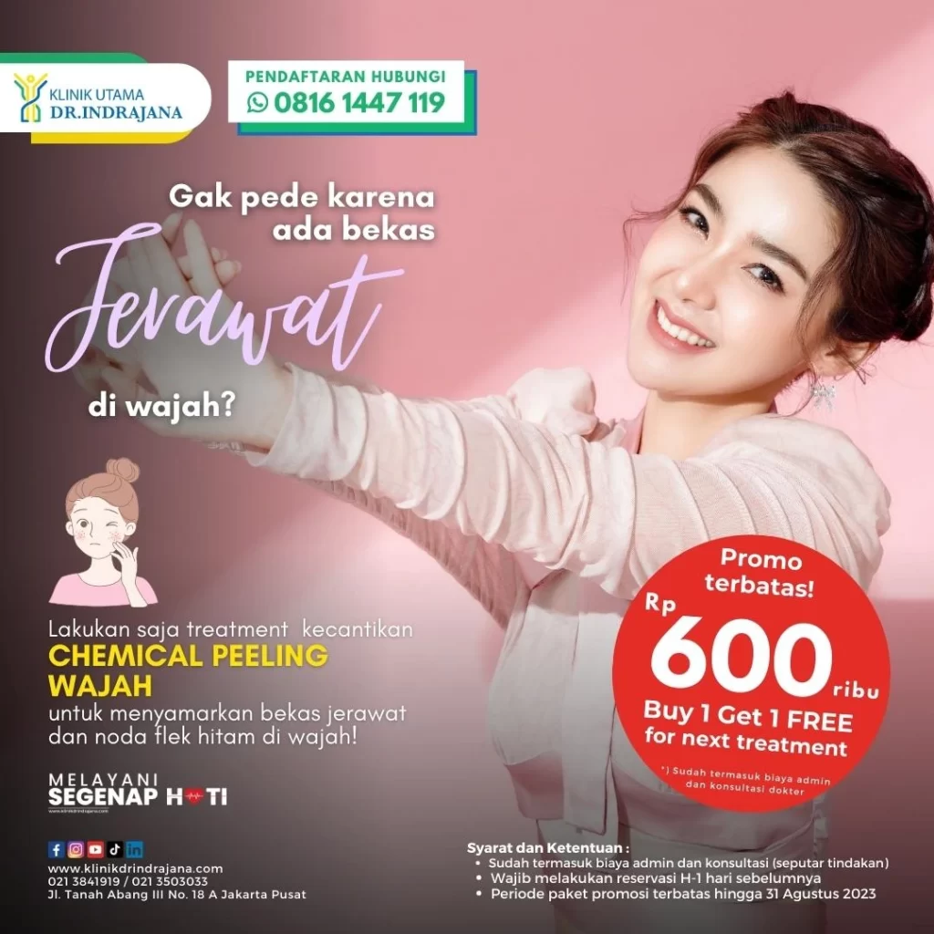 Banner Promo Chemical Peeling Klinik Utama DR Indrajana
