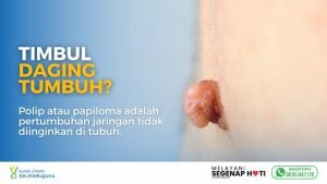 header untuk halaman melakukan elektrokauter menghilangkan daging tumbuh - Klinik Utama DR Indrajana