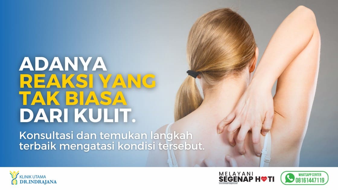 gambar seorang wanita sedang mengalami gark dari reaksi kulit, sebagai banner untuk melakukan tes alergi di Klink Utama DR Indrajana.