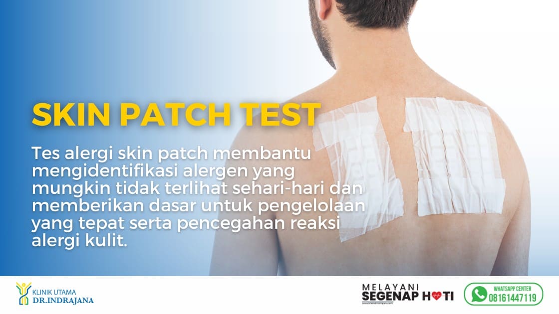banner untuk melakukan tes alergi skin patch test di Klink Utama DR Indrajana.