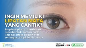 Dokter Bedah Plastik - Blepharoplasty - Operasi Kantung Mata