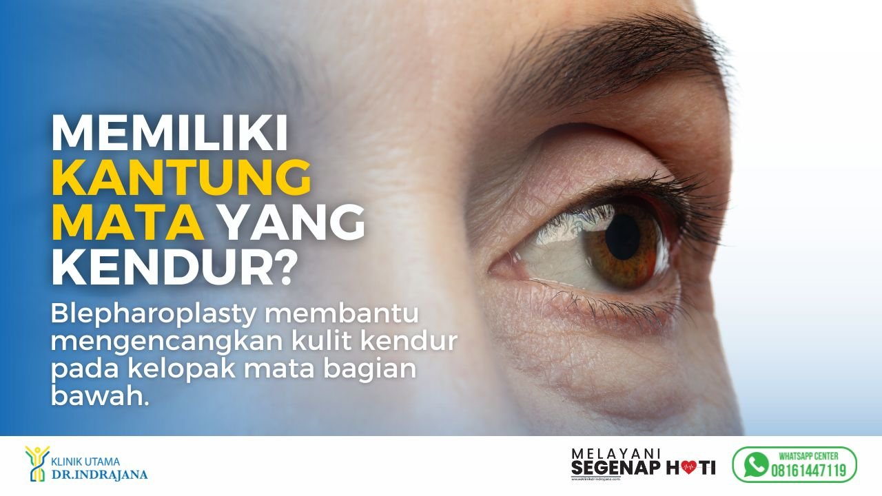 Dokter Bedah Plastik - Blepharoplasty - Operasi Kantung Mata