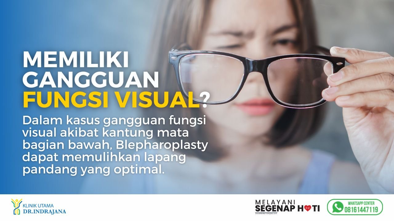 Dokter Bedah Plastik - Blepharoplasty - Operasi Kantung Mata