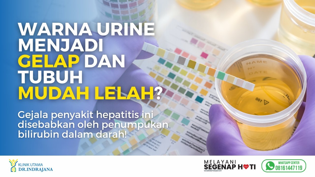 Hepatitis - Klinik Utama DR Indrajana (3)