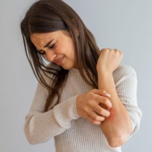 Penyakit Kulit Eksim - Klinik Utama DR Indrajana (2)