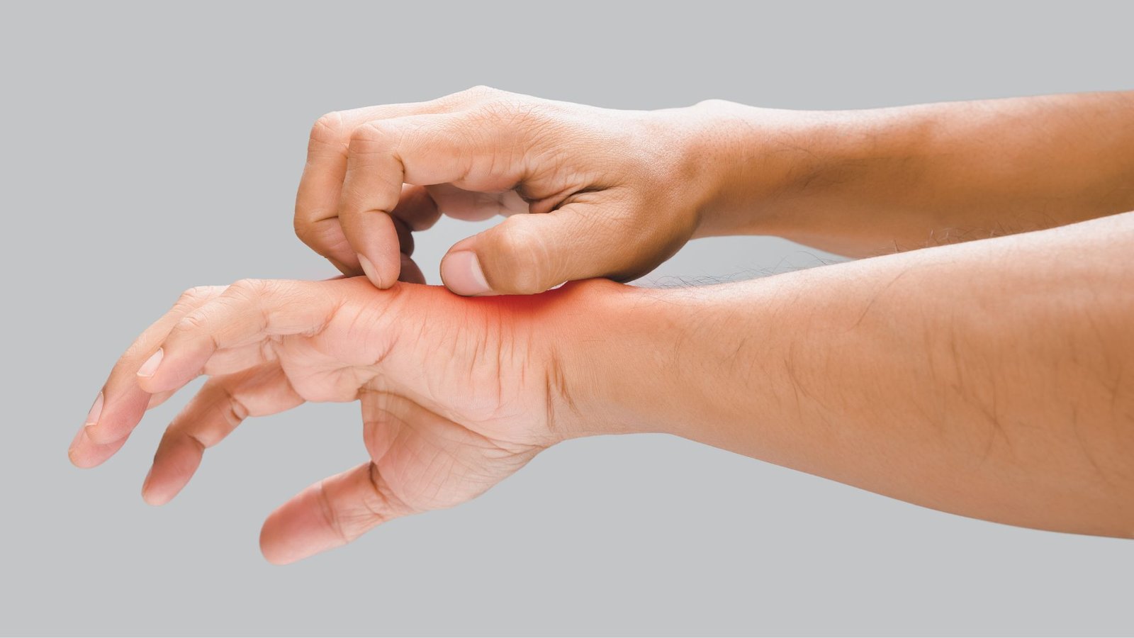 Dermatitis - Klinik Kulit dan Kelamin (3)