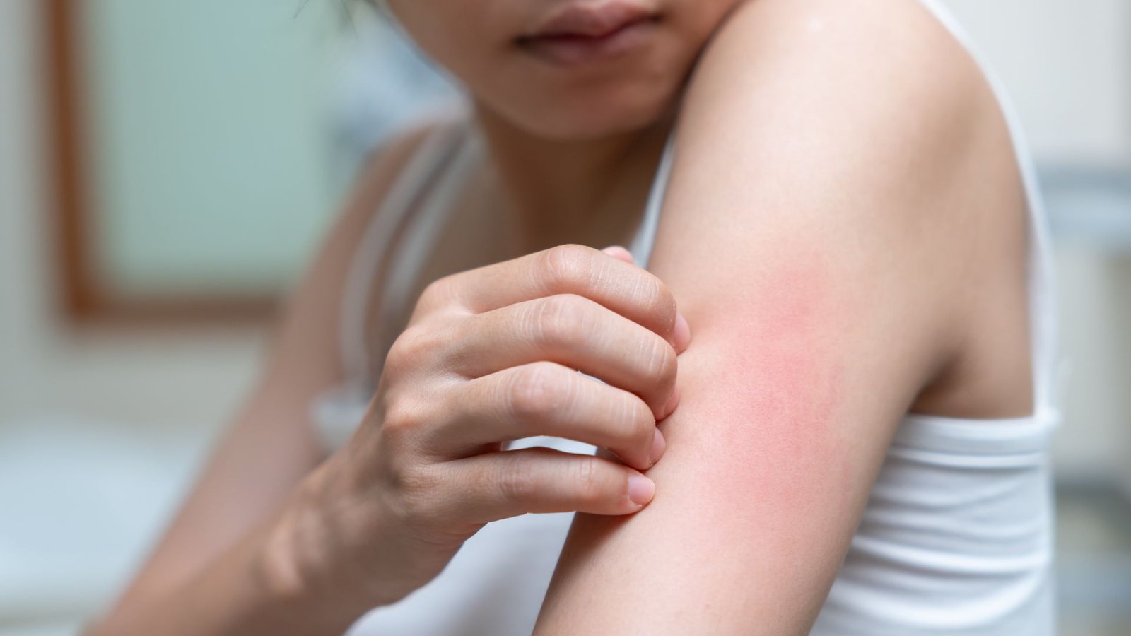 Gejala Infeksi Jamur Candidiasis - Klinik Utama DR Indrajana