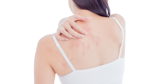 Risiko Infeksi Jamur - Klinik Utama DR Indrajana