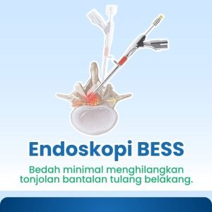 metode atau tindakan endoskopi bess bedah saraf di klinik utama dr. indrajana