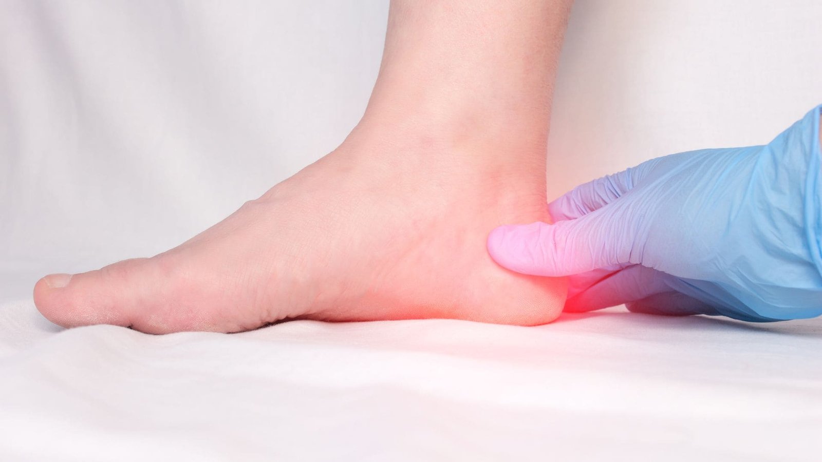 ilsustrasi taji tumit yg nyeri atau disebut Plantar Fasciitis dapat diatasi di klinik utama dr. indrajana.