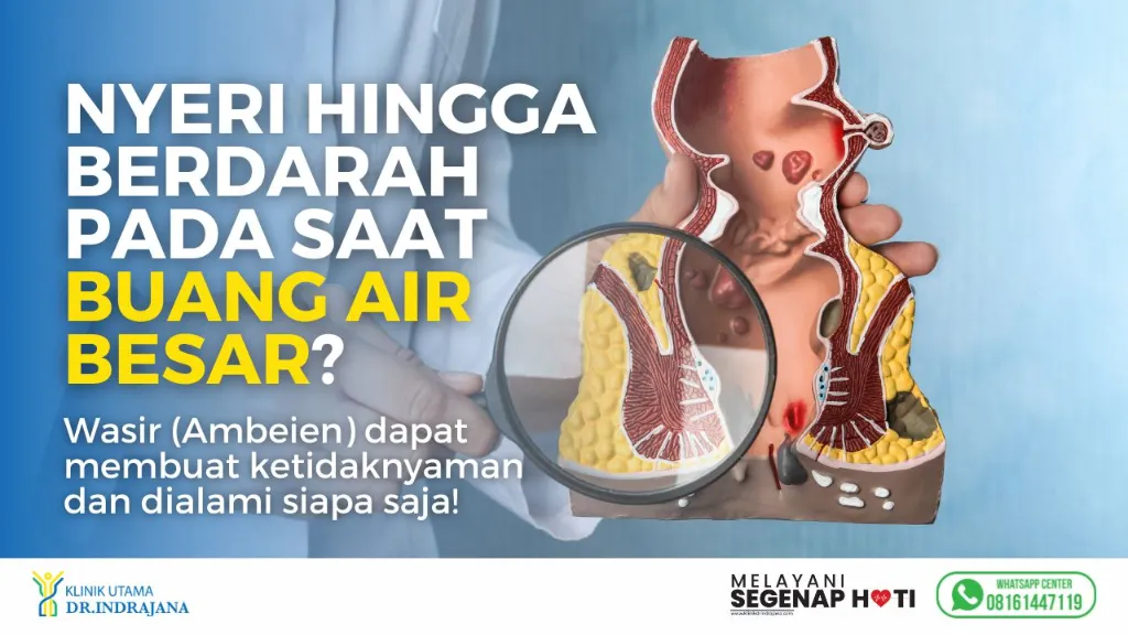 Banner Keluhan Klinik Spesialis Bedah Umum (2)