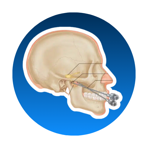 Percutaneous Balloon Compression - Klinik Utama DR Indrajana