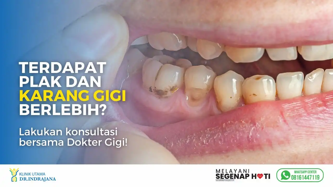 Permasalahan pada Gigi - Dokter Gigi - Klinik Gigi Klinik Utama DR Indrajana