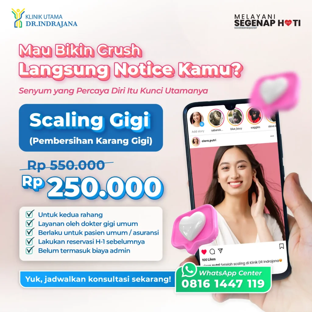 Promo Klinik Gigi - Klinik Utama DR Indrajana - Scaling Gigi