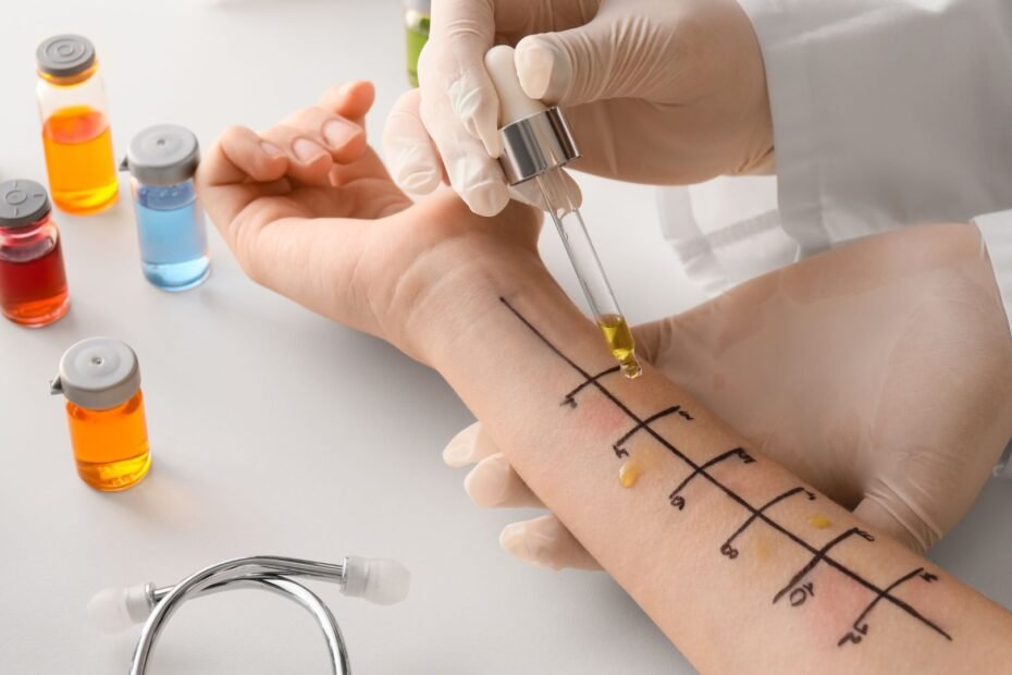 Biaya Test Alergi - Klinik Utama DR Indrajana