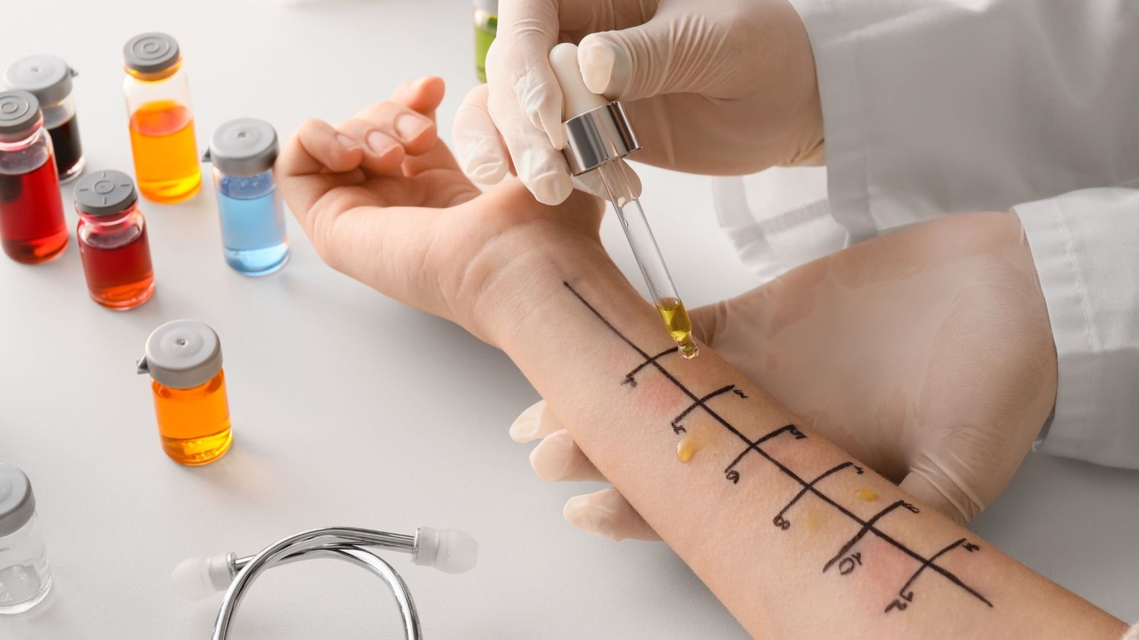 Test Alergi – Klinik Utama DR Indrajana