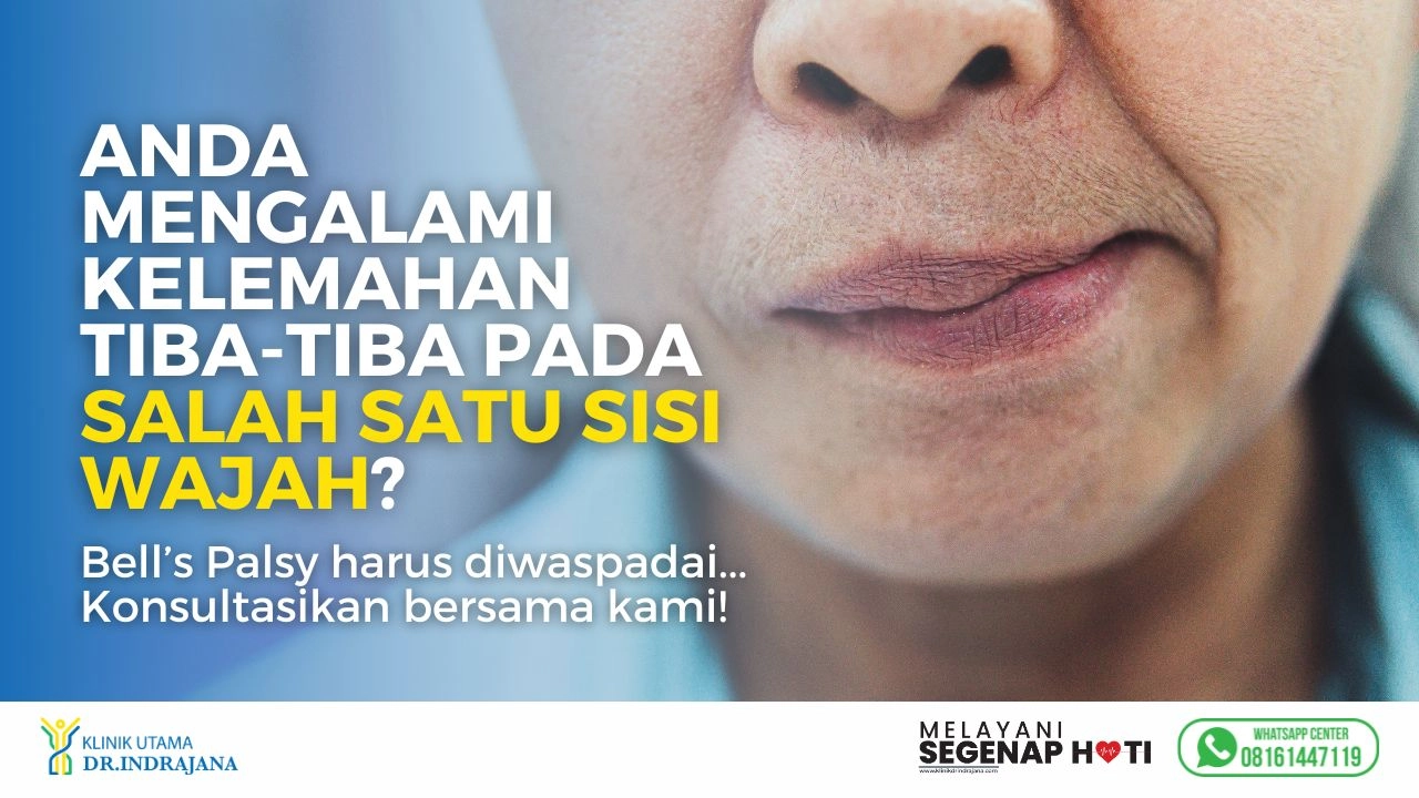 Bell's Palsy - Klinik Saraf Neurologi - Klinik Utama DR Indrajana