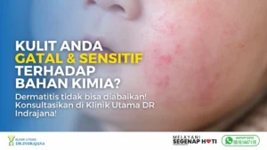 Dermatitis - Klinik Kulit dan Kelamin - Klinik Utama DR Indrajana