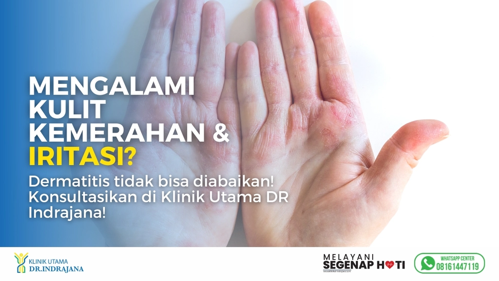 Dermatitis - Klinik Kulit dan Kelamin - Klinik Utama DR Indrajana
