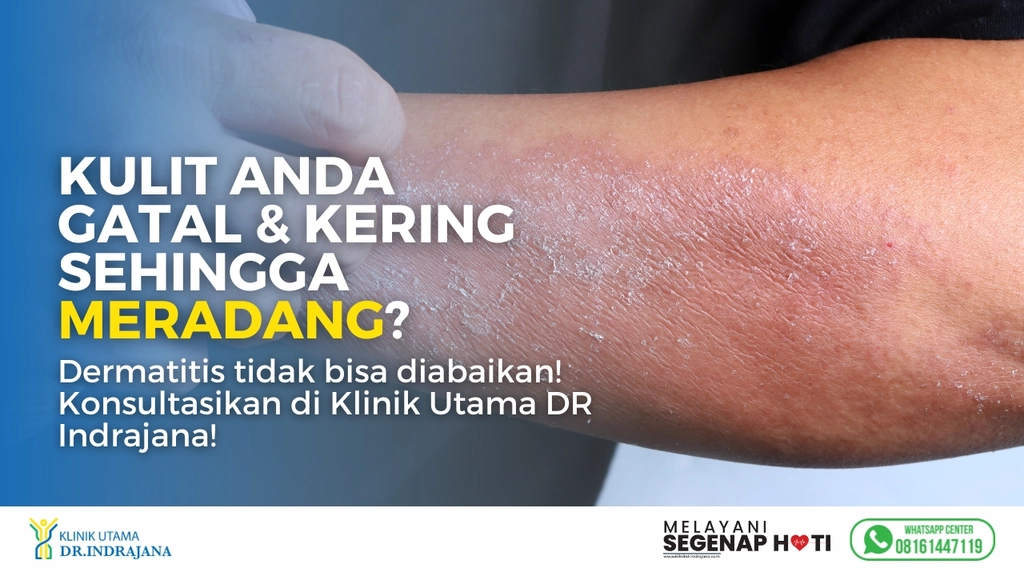 Dermatitis - Klinik Kulit dan Kelamin - Klinik Utama DR Indrajana