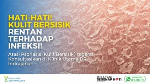 Psoriasis Kulit Bersisik - Klinik Kulit dan Kelamin - Klinik Utama DR Indrajana