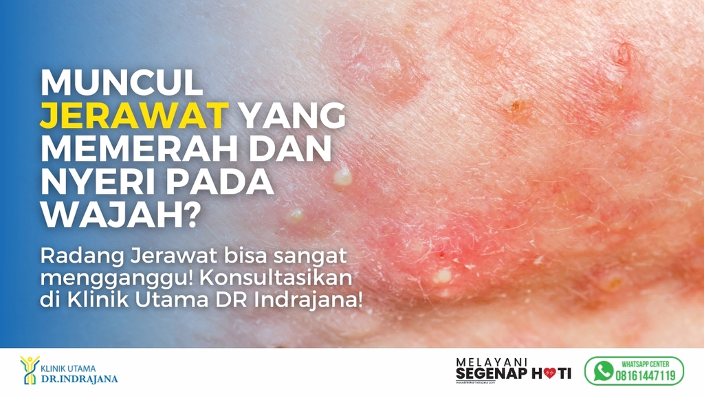 Suntik Jerawat - Klinik Kulit dan Kelamin - Klinik Utama DR Indrajana