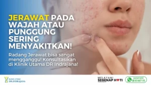 Suntik Jerawat - Klinik Kulit dan Kelamin - Klinik Utama DR Indrajana