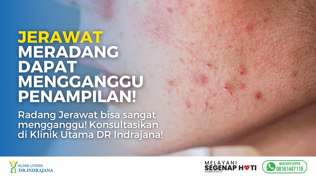 Suntik Jerawat - Klinik Kulit dan Kelamin - Klinik Utama DR Indrajana