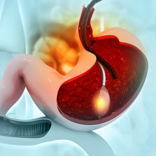 Klinik Dokter Spesialis Gizi Klinik - Klinik Utama DR Indrajana