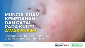 Konsultasi Eksim - Klinik Utama DR Indrajana