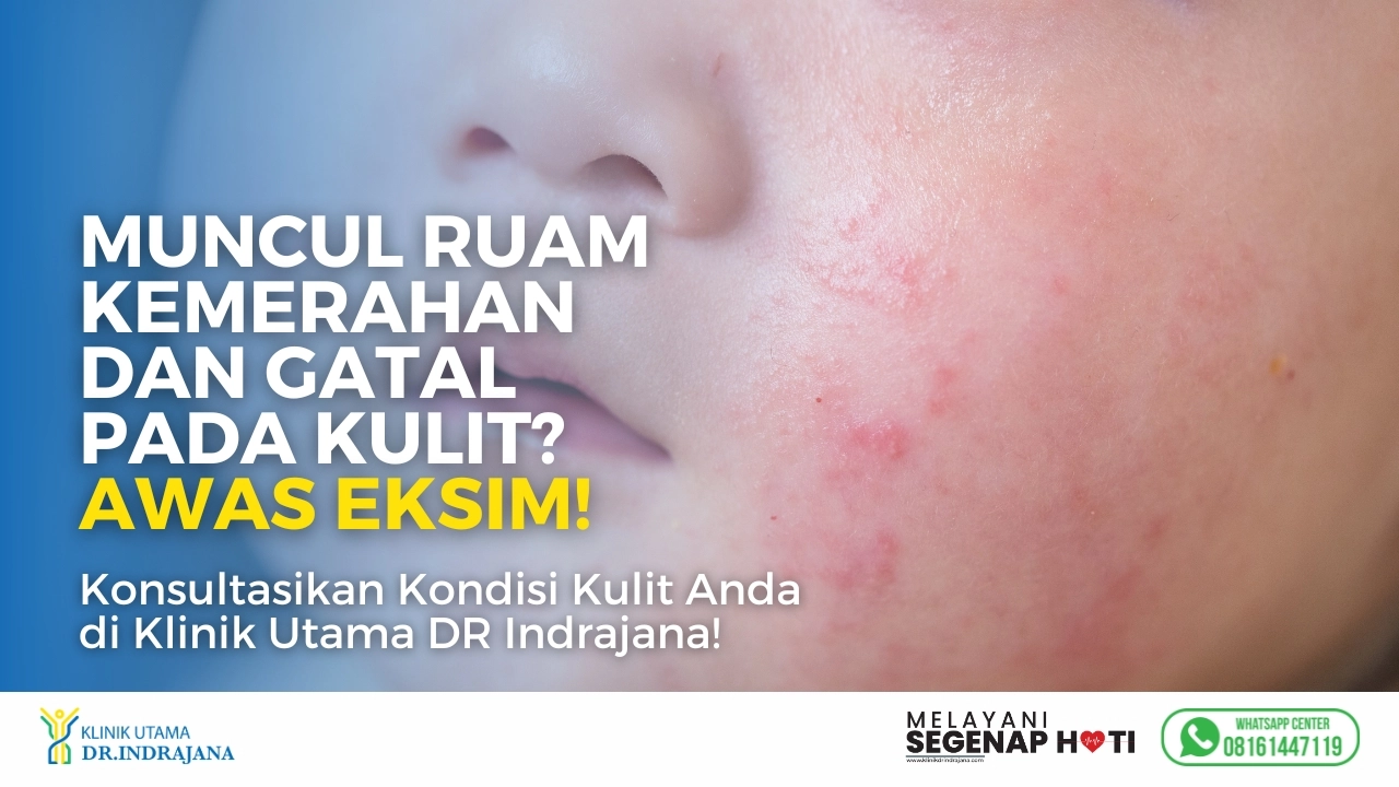 Konsultasi Eksim - Klinik Utama DR Indrajana