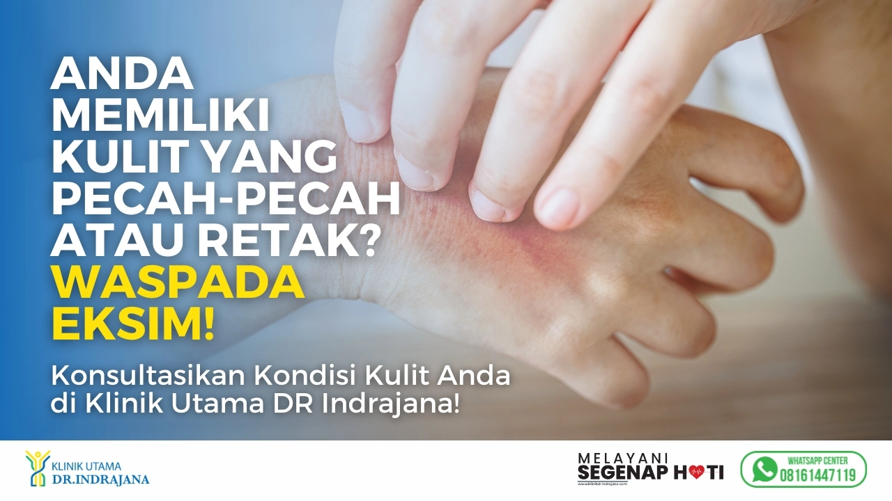 Konsultasi Eksim - Klinik Utama DR Indrajana