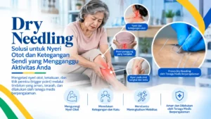 Fisioterapi - Dry Needling - Rumah Sakit DR. Indrajana