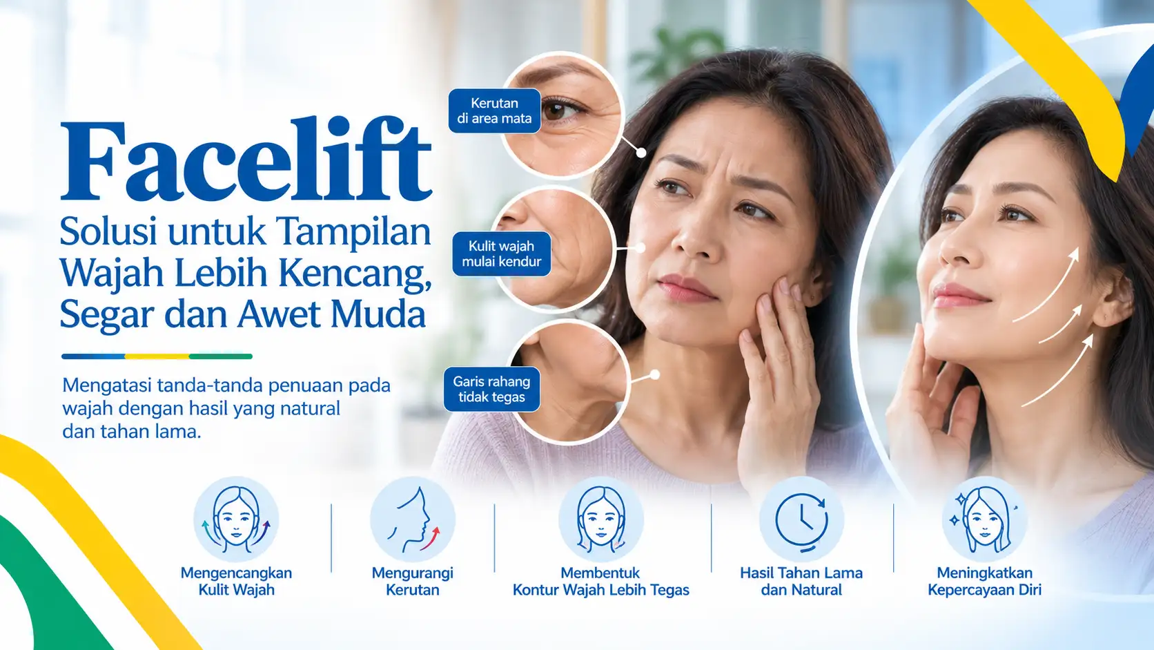Klinik Bedah Plastik - Facelift - Rumah Sakit DR. Indrajana